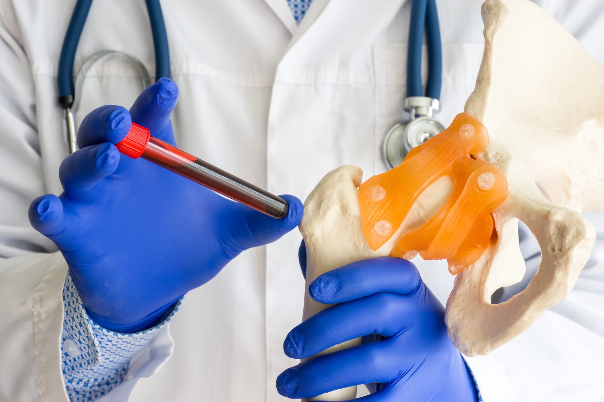 Musculoskeletal lesions-Trauma-Non-surgical management-Arthritis-Sports Medicine-General Orthopedics-Human Performance-Joint Preservation-Sports Medicine-Arthroscopy-Pain Management-Total Joint Replacements-Foot & Ankle-Patrick Tyrance, Jr. MD- Orthopedic Surgeon-Delray Beach,Florida-