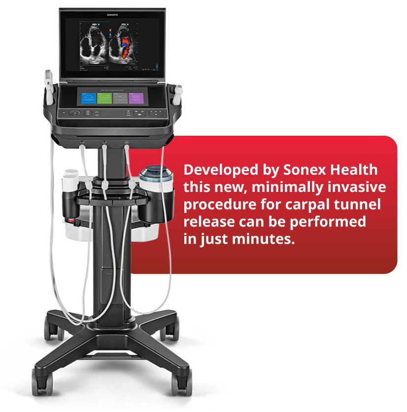 UltraGuideCTR device for ultrasound-guided carpal tunnel release at TOSM, Delray Beach, FL