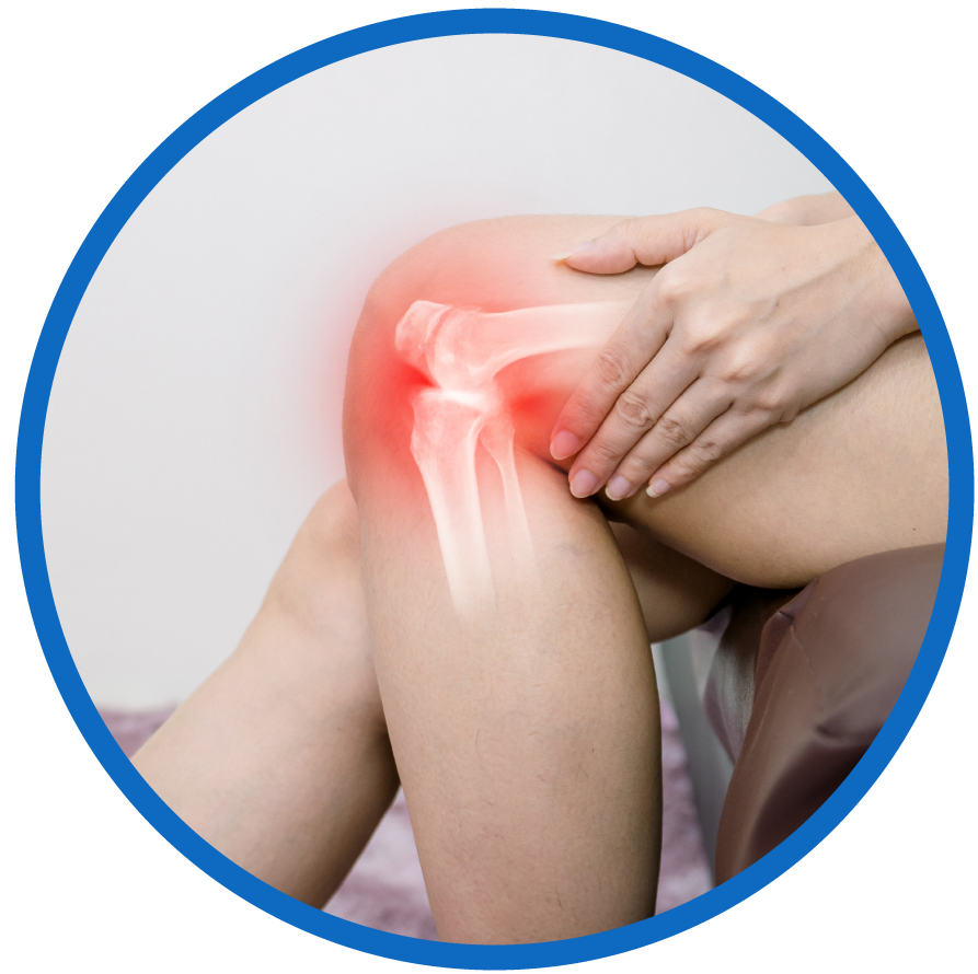 Cartilage-Damage-TOSM