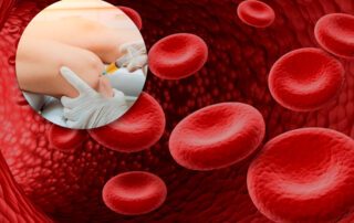 Platelet-Rich Plasma (PRP) therapy at TOSM Delray Beach