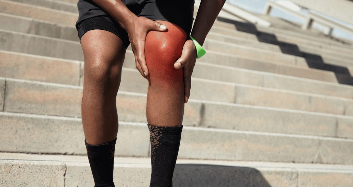 Runner gripping a red, inflamed knee on outdoor stairs, illustrating knee osteoarthritis pain treated with regenerative options at Tyrance Orthopedics in Delray Beach.
