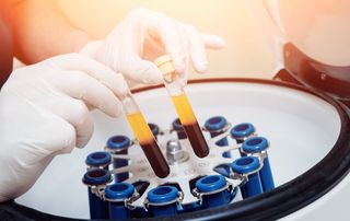 Gloved clinician loading blood tubes with separated platelet-rich plasma into a centrifuge to prepare a PRP shoulder injection at Tyrance Orthopedics in Delray Beach.