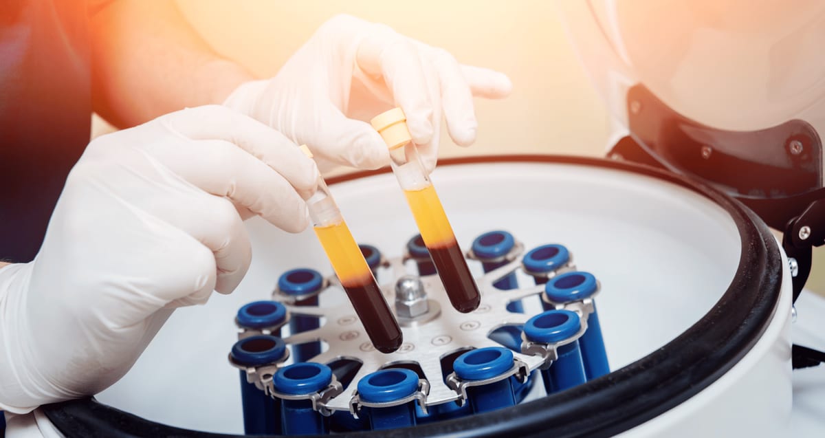 Gloved clinician loading blood tubes with separated platelet-rich plasma into a centrifuge to prepare a PRP shoulder injection at Tyrance Orthopedics in Delray Beach.