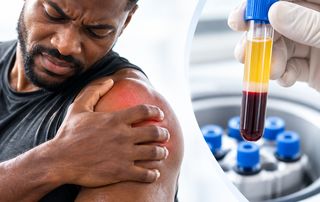 Provider preparing a platelet-rich plasma (PRP) injection to treat a patient's shoulder pain.
