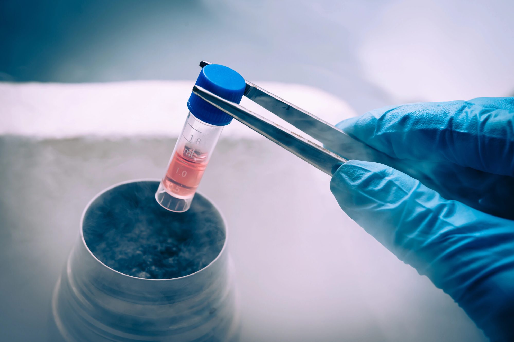 Tyrance Orthopedics, Stem Cell,, BMAC Therapy in Delray Beach BMAC Therapy, Tyrance Orthopedics, Delray Beach